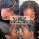 Bye~Bye~KNOTS HD Lace 13x6 Frontal Wig - Burmese Curly with Curly Edge